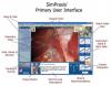 SimPraxis Laparoscopic Cholecystectomy Trainer