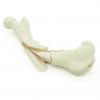 Canine Femur with comminuted fracture